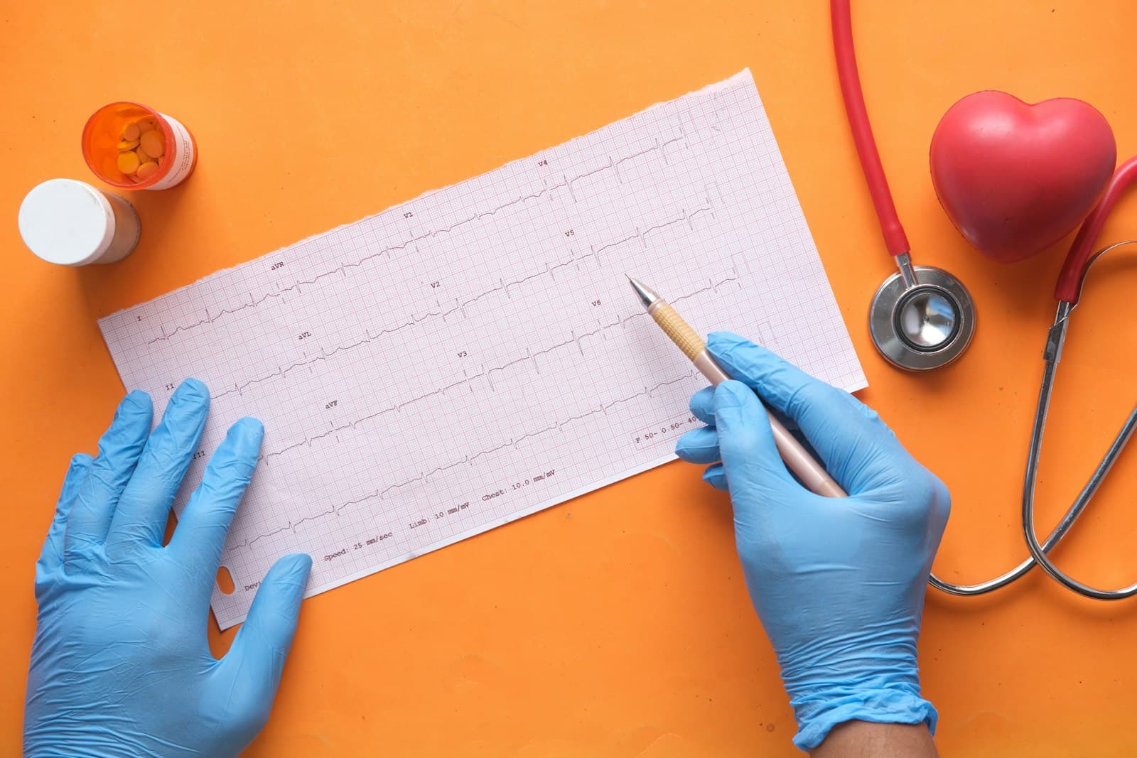 Quels sont les signes d'une crise cardiaque ? Reconnaître un infarctus